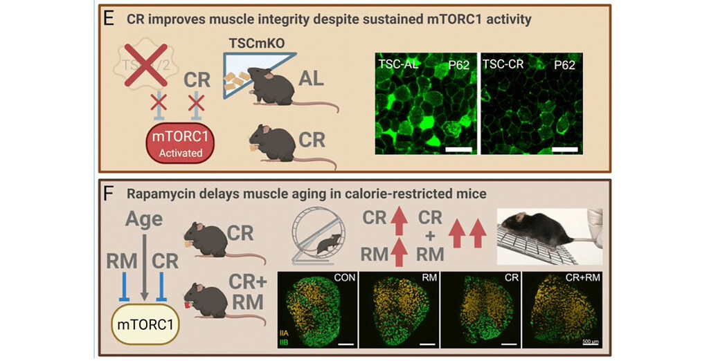 Even With Calorie Restriction Rapamycin Slows Muscle Aging News